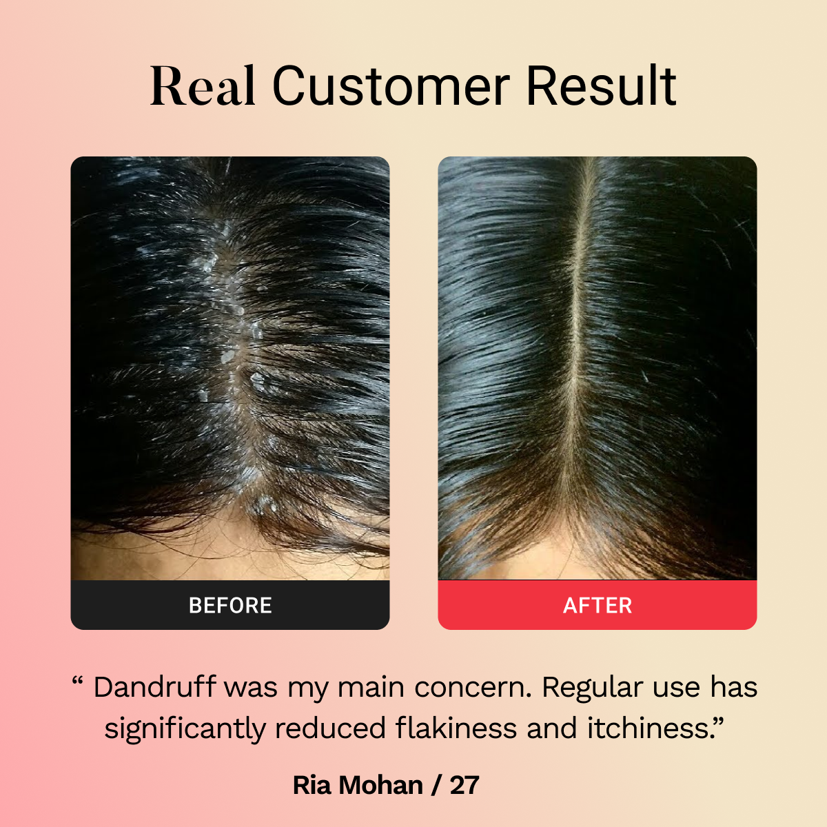 Glamora Hair Regrowth Bundle Kit